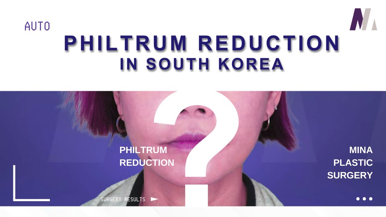 PHILTRUM REDUCTION IN KOREA