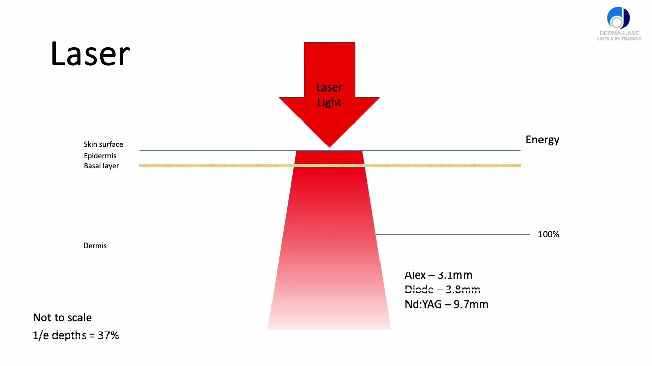 How do lasers compare with IPLs in terms of hair removal - V2
