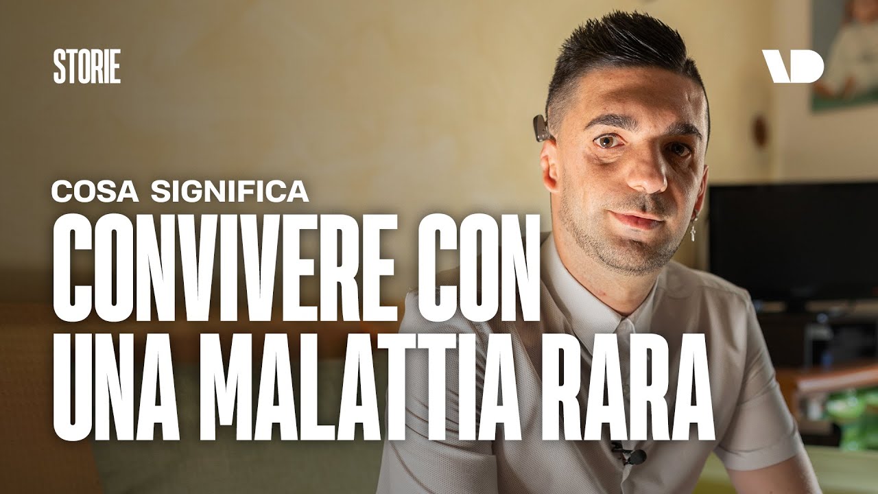 Convivere con la sindrome di Treacher Collins: la storia di Raffaele Capperi