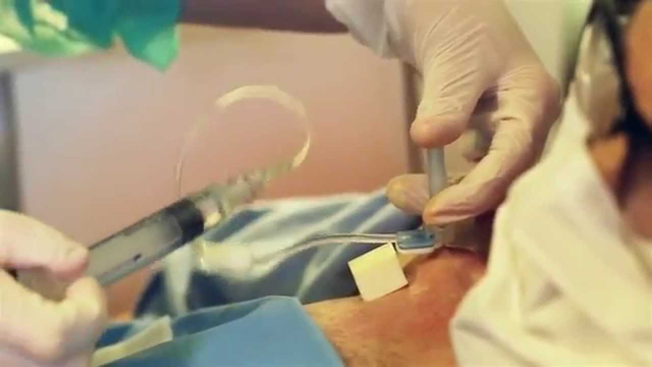 Sécuriser les soins sur chambres à cathéter implantable au domicile