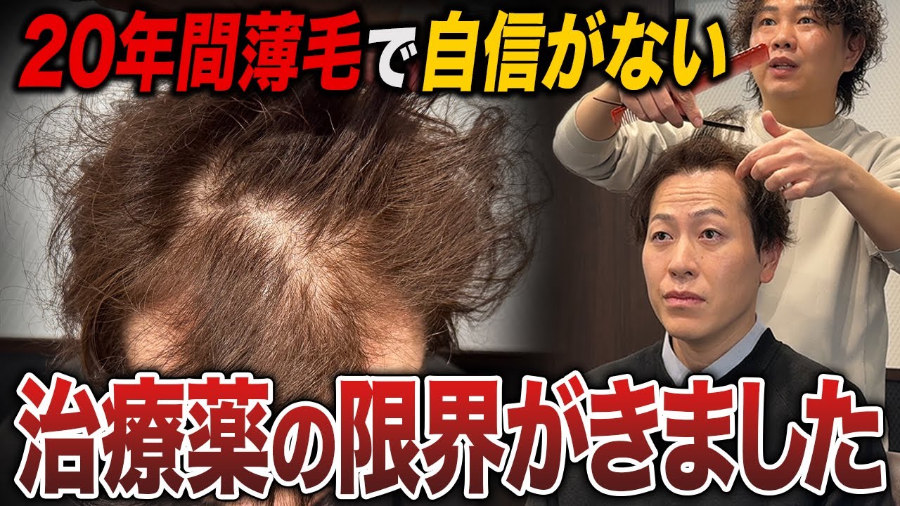 【初登場】20年以上薄毛に悩み続けた男性が下した最終決断