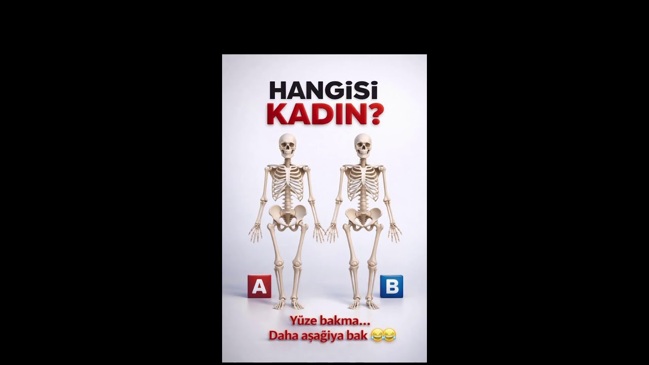 %90 Yanılıyor! Cevabı Sesini Dinleyerek Bul 👂🧠 #kesfet #keşfet #shorts