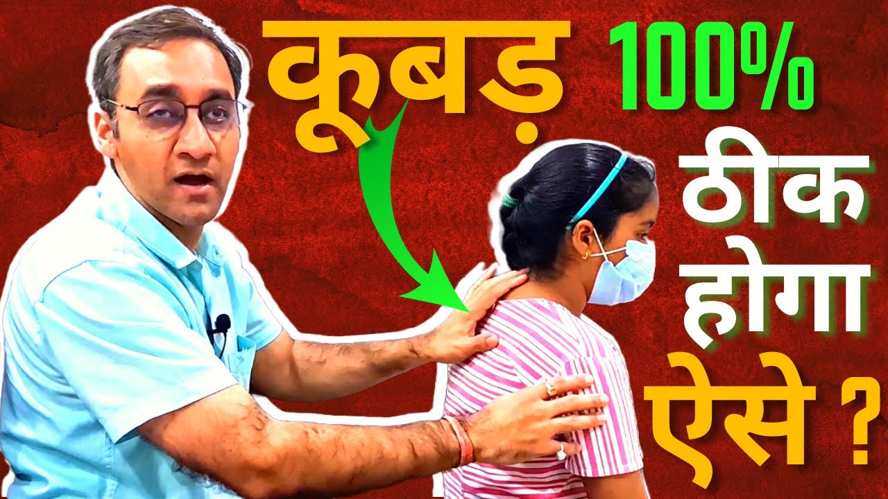 कूबड़ कैसे ठीक करें | Kyphosis  | Dr. Abhiinav Chaturvedii | Rooprani Health Cares