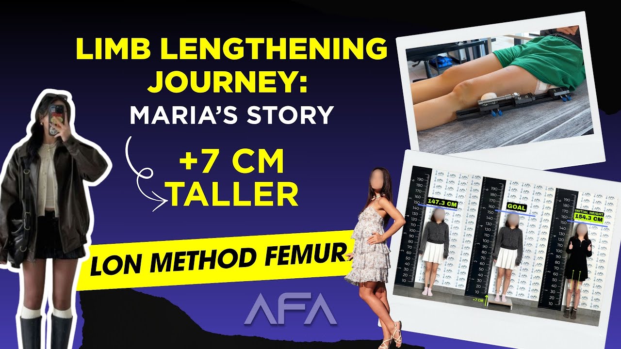 LIMB LENGTHENING JOURNEY: MARIA'S STORY / +7 CM TALLER!