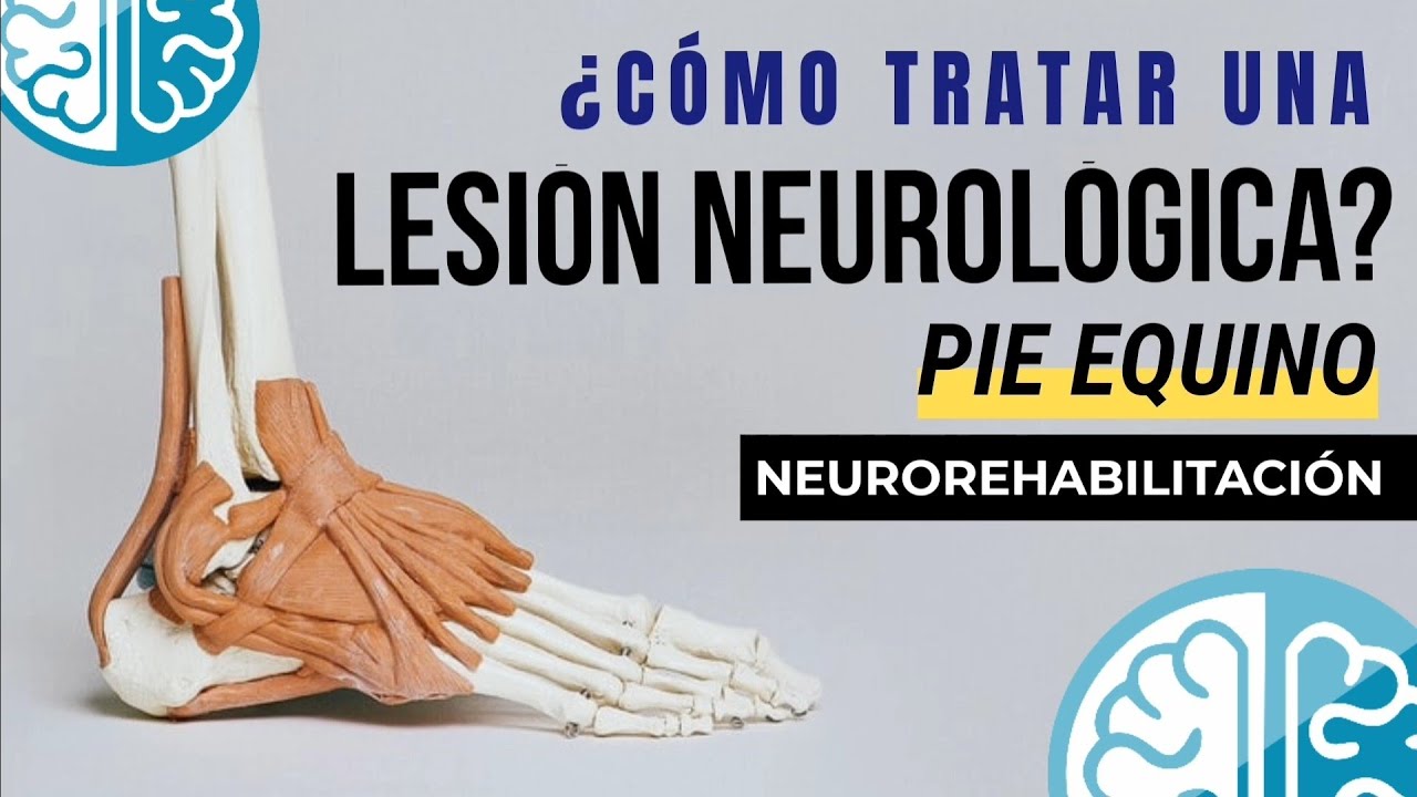 🧠 REHABILITACIÓN NEUROLÓGICA 🦶 Pie Equino / Lesión Cerebral