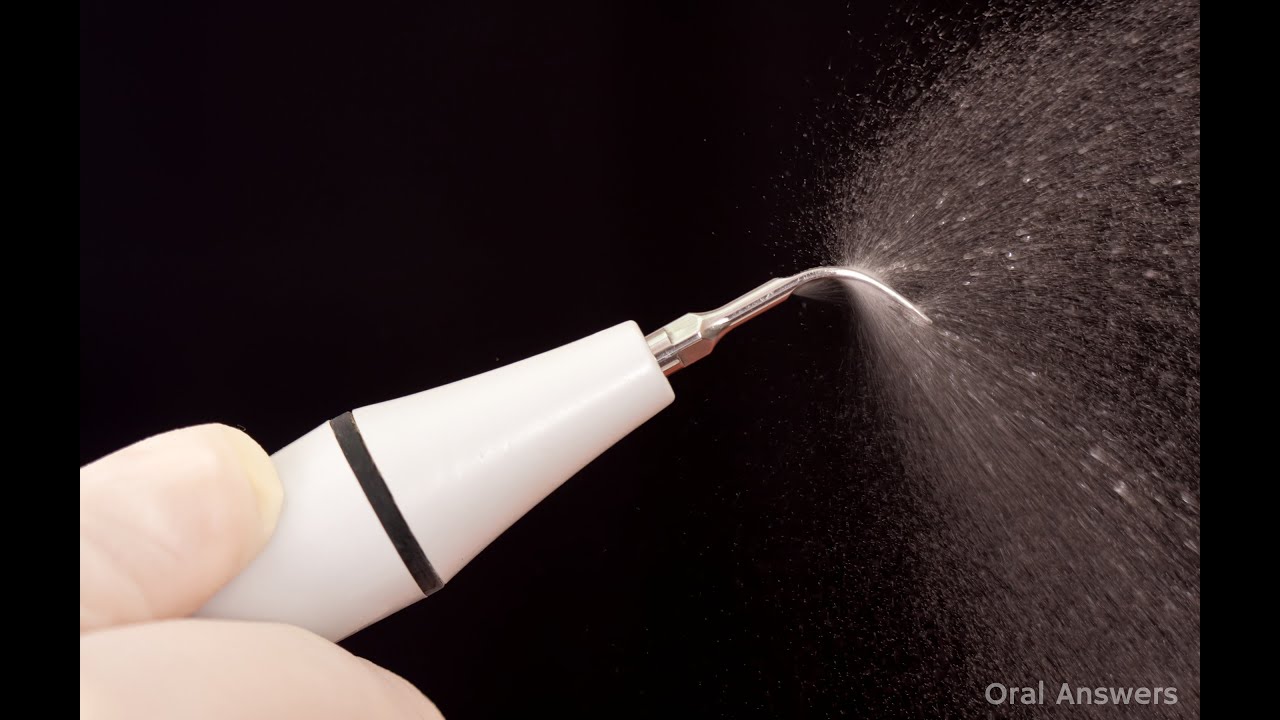 What does Ultrasonic scaler do