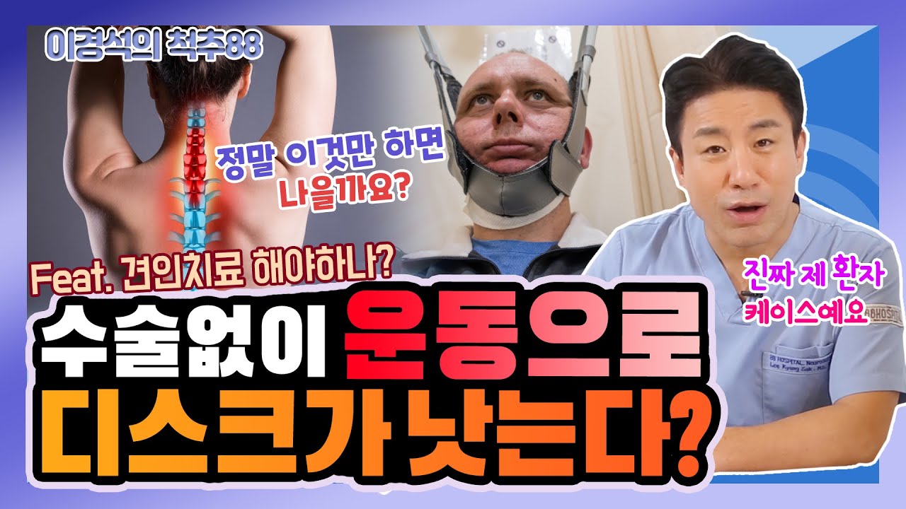 수술 없이도 심한 목디스크를 완치시킨 운동의 정체는? (Feat. 견인치료) - 이경석의 척추88 #36