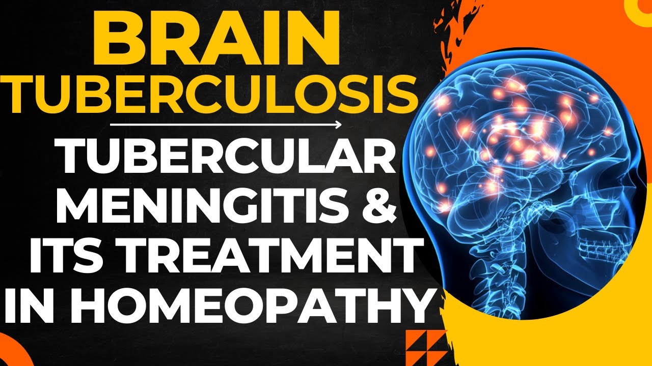 BRAIN TB || TUBERCULAR MENINGITIS || BEST HOMEOPATHIC MEDICINE FOR TUBERCULAR MENINGITIS !