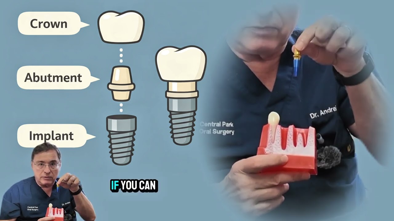 What to Expect with Dental Implants: Process, Timeline, and Components.