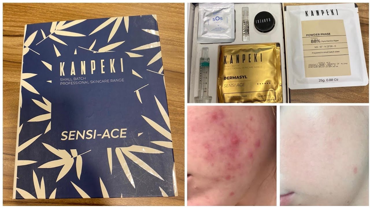 Acne facial / Kanpeki facial benefits/ kanpeki Japanese facial kit