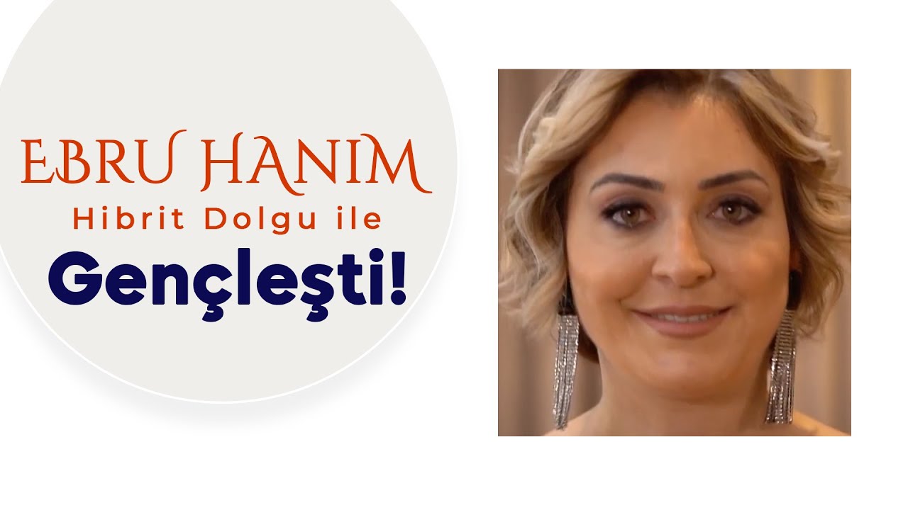Ebru Hanım Hibrit Dolgu ile Gençleşti! | Dr. Seran GÖÇER