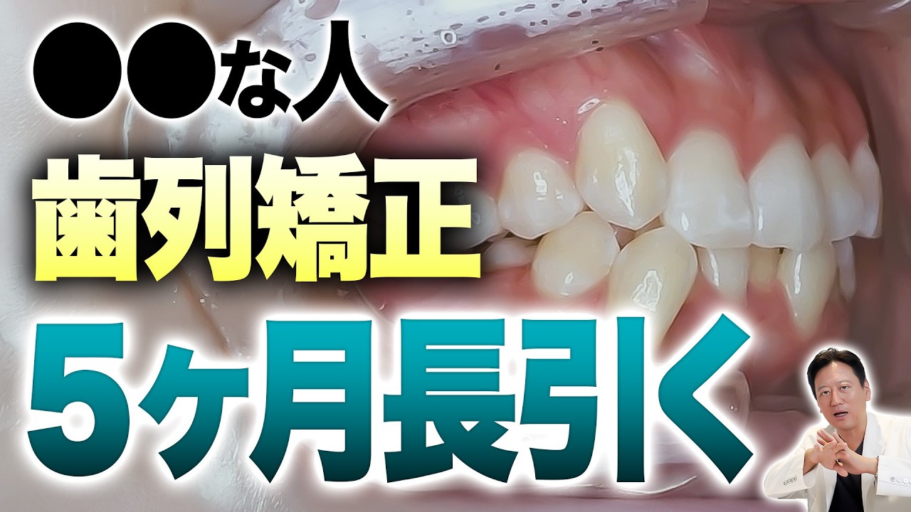矯正が長引く歯並びって？ガチャ歯で〇〇な人の症例を徹底解説します【審美歯科 歯列矯正 歯並び 正中ずれ】