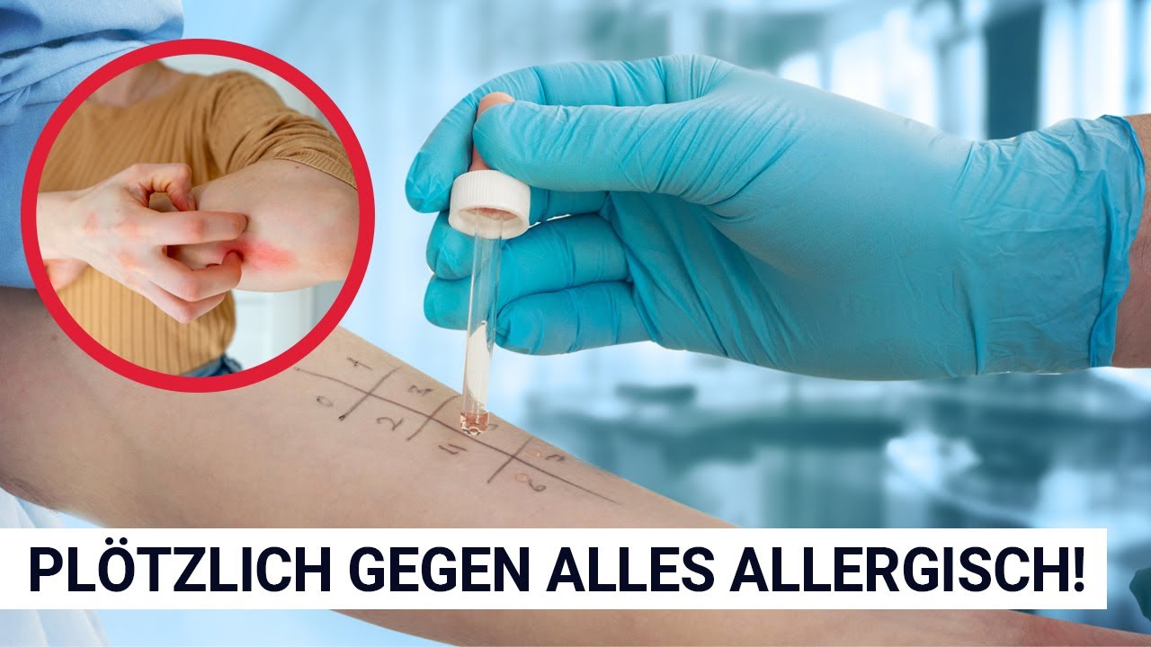 Plötzlich gegen alles allergisch!