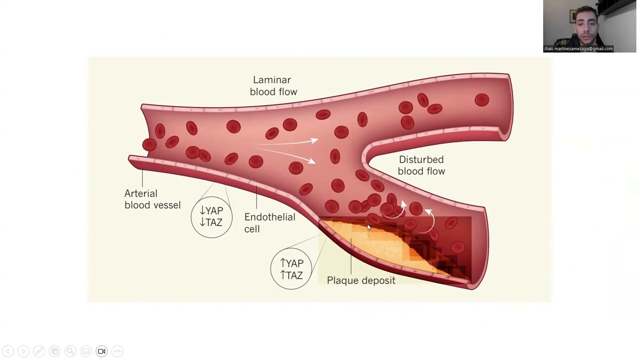 Fisiopatología de la aterogénesis
