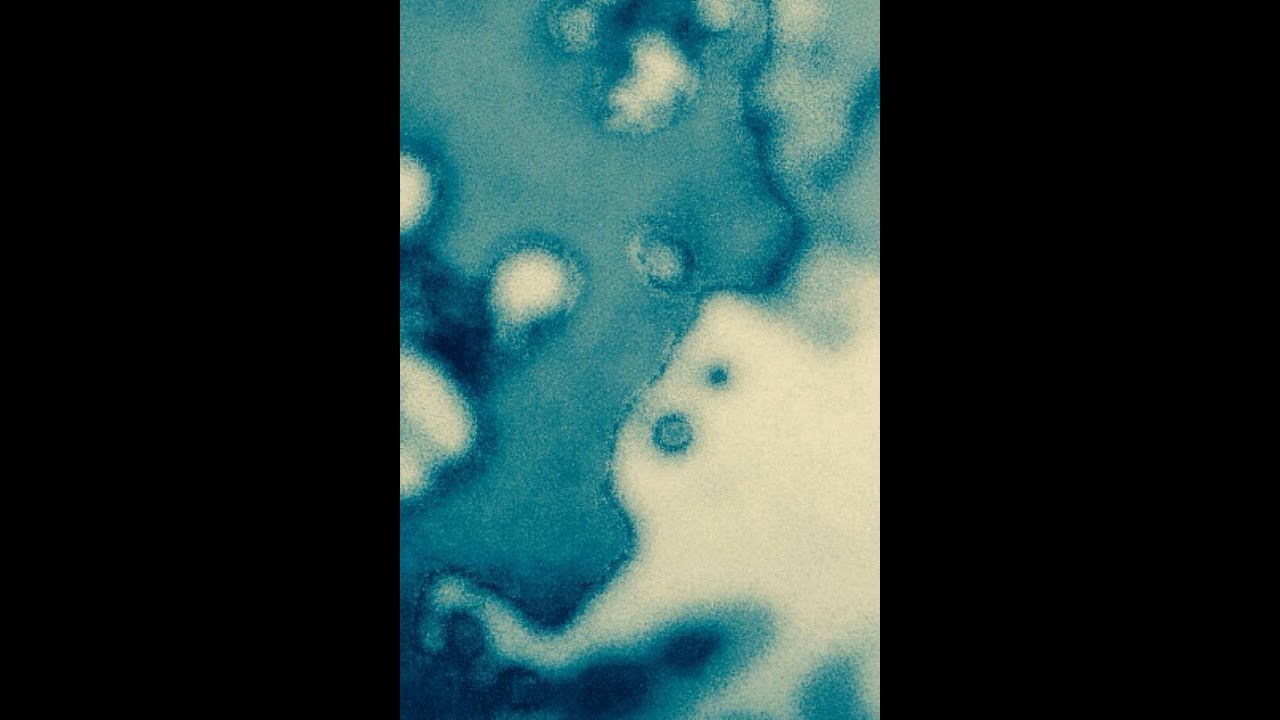 Exit The Building - Deprim Planet (Full Album)