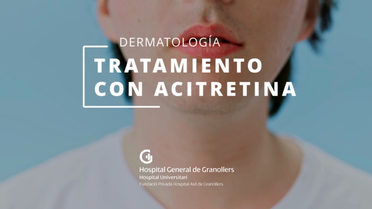 Tratamiento con Acitretina
