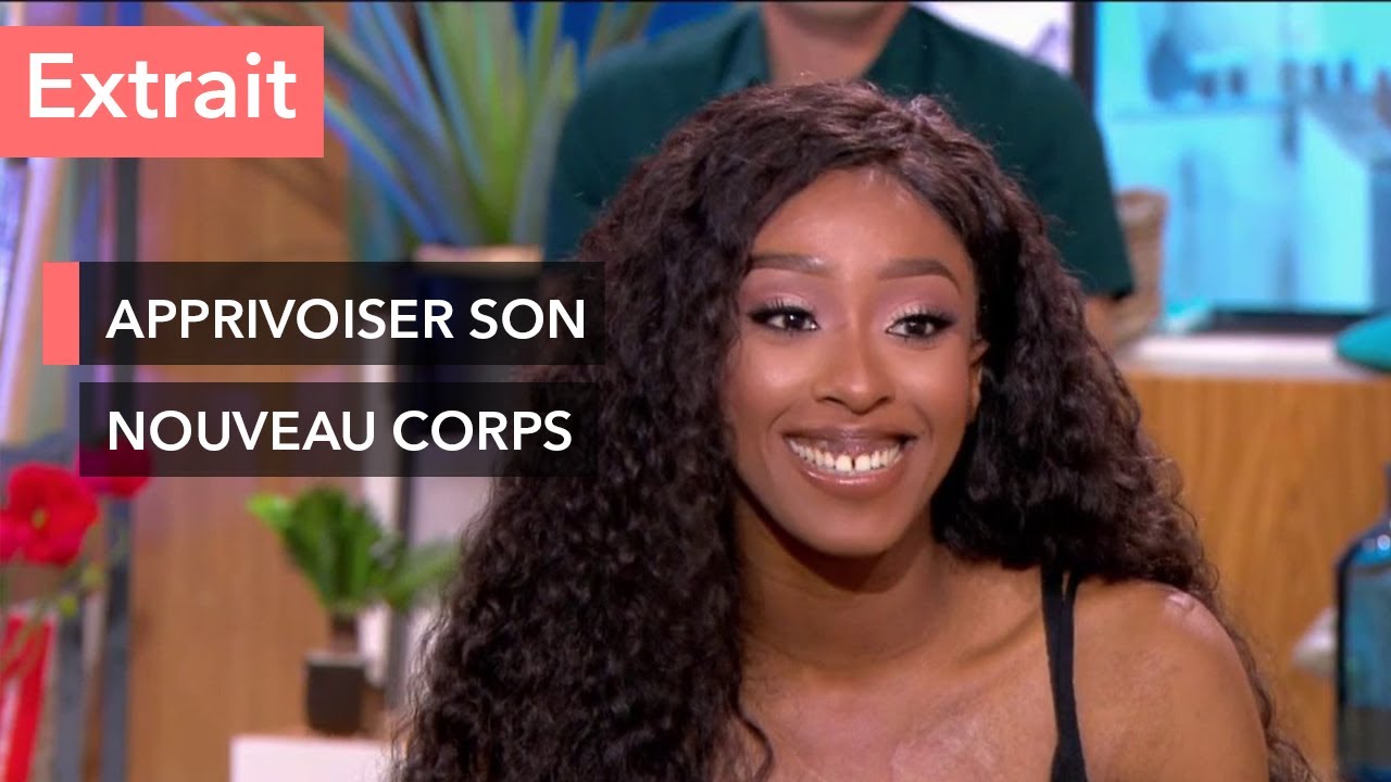 Miraculée d'un incendie à l'âge de 4 ans - Ça commence aujourd'hui