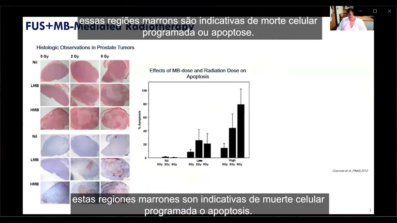 Opportunities and Risks of Machine Learning in Echocardiography - Danay Valenzuela Rodríguez
