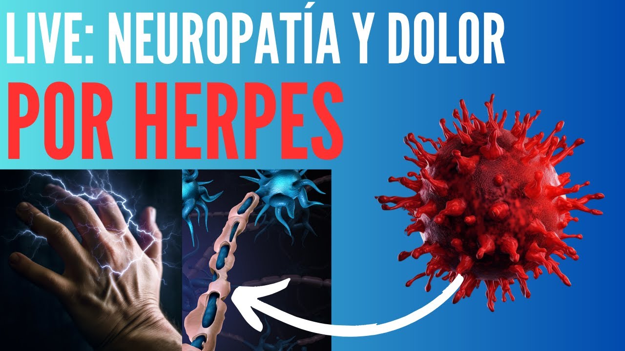 Live: Neuropatía y dolor por herpes