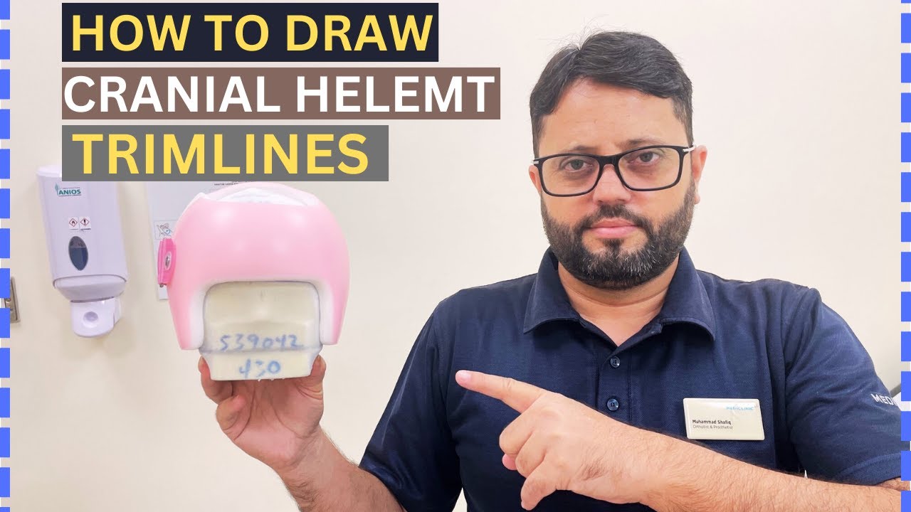 Trim lines Of Cranial Remolding Orthosis | Cranial Helmet Trim line Adjustments