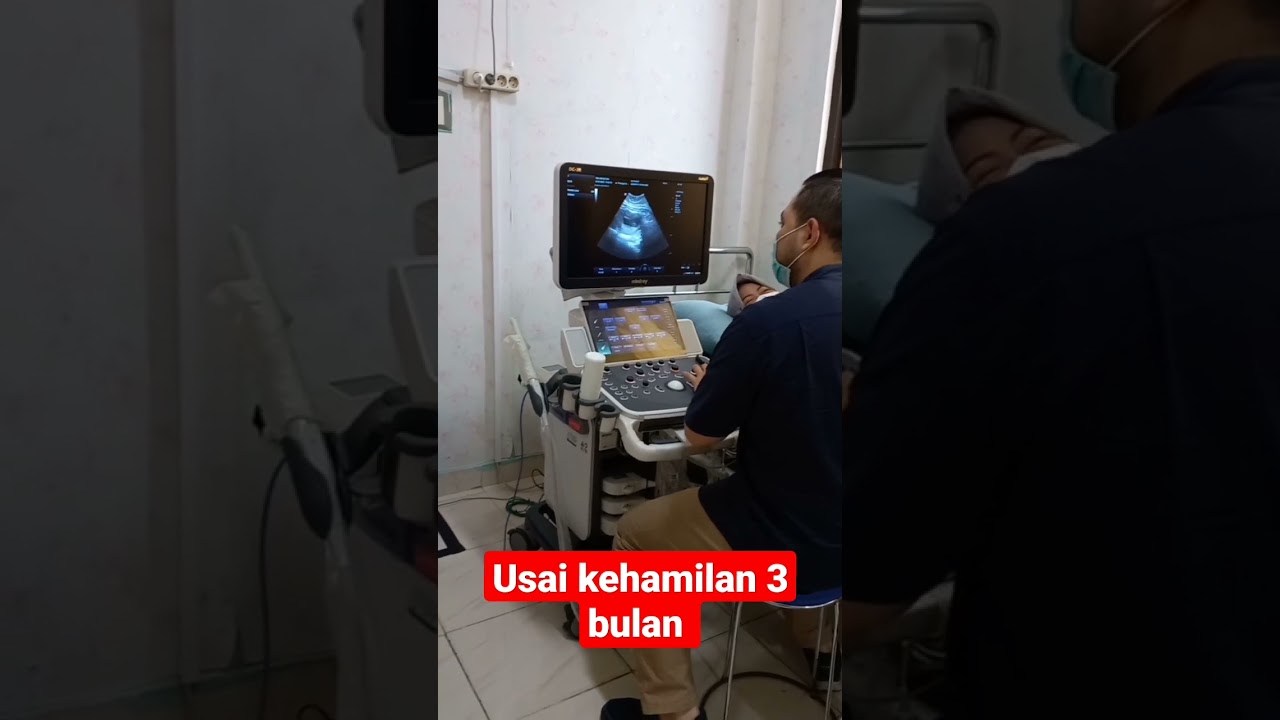 nemenin istri usg  kehamilan || usia kehamilan 3 bulan