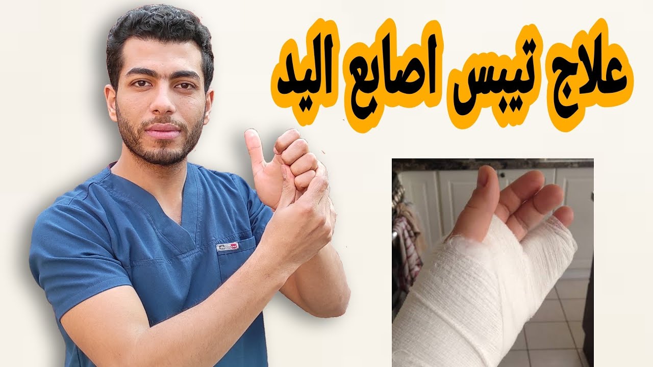 ب 3تمارين بس هتتخلص من تيبس الاصابع بعد الجبس نهائيا |علاج تيبس اصابع اليد