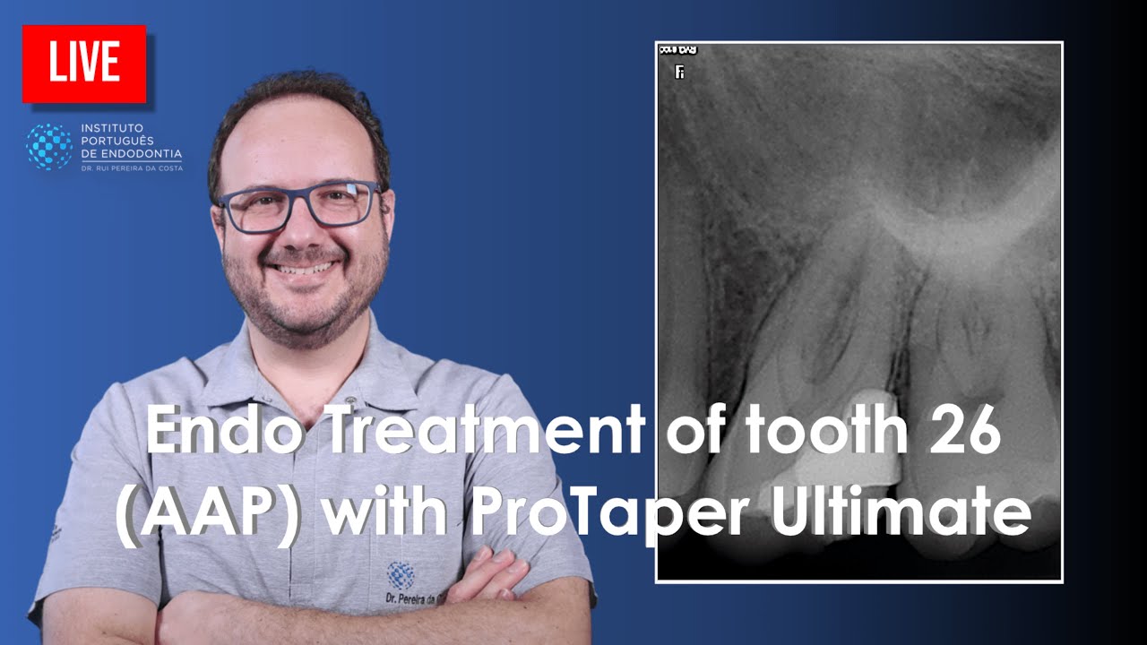 🔴 Endo Treatment of tooth 26 (AAP) with ProTaper Ultimate