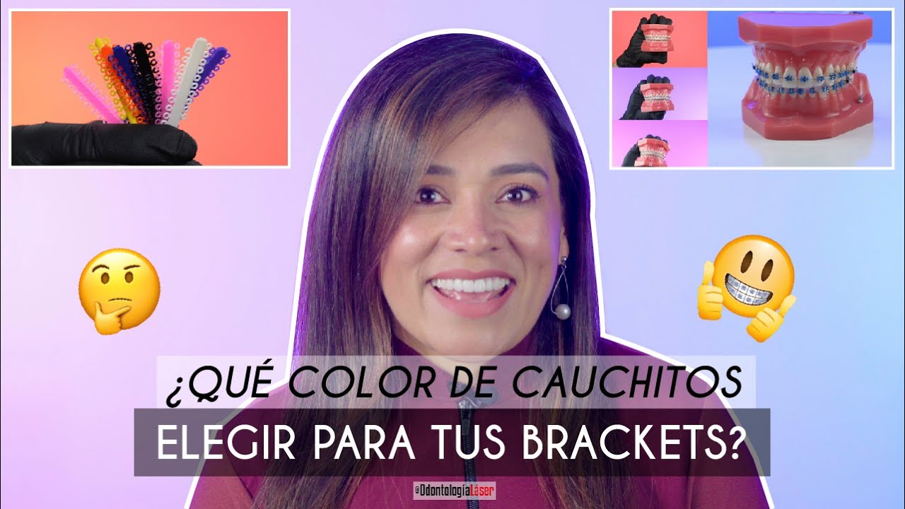 ¿Qué Color de Cauchos Elegir en mis Brackets? ¿Cuál me beneficia? 🎨 - Odontología Láser
