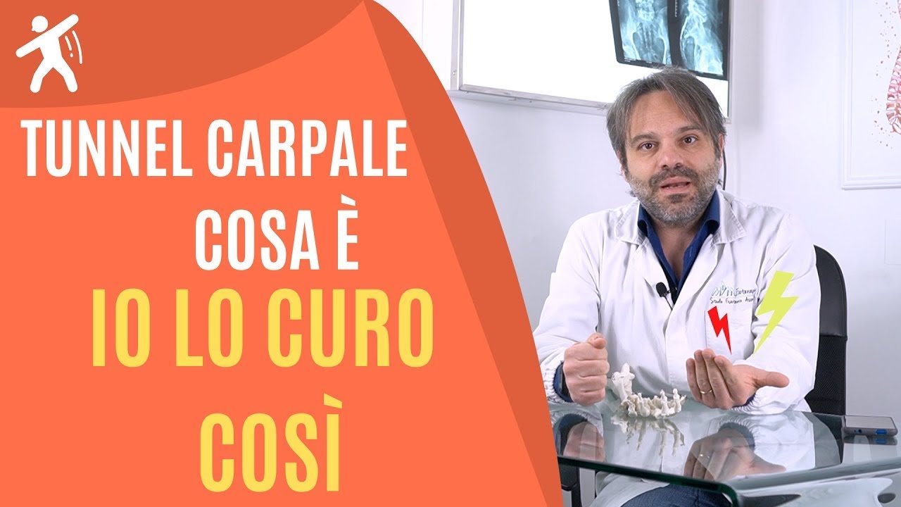 Tunnel Carpale | la CURA che FUNZIONA