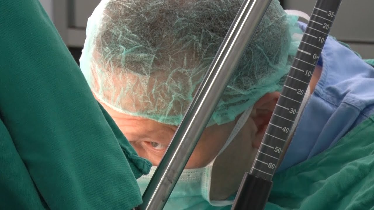 Operacija hemoroida - thd procedura