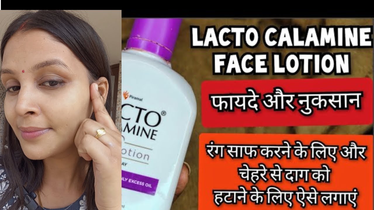 "Lacto Calamine Face Lotion Review | Best for Oily & Acne-Prone Skin?"