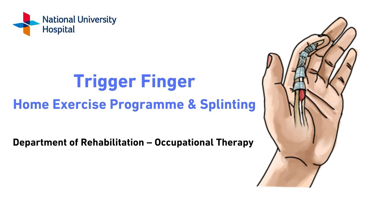 Management of Trigger Finger (Home Exercise Programme and Splinting)