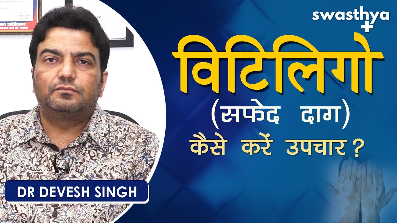 विटिलिगो (सफेद दाग) – कैसे करें इलाज | Dr Devesh Singh on Vitiligo in Hindi | Causes & Treatment