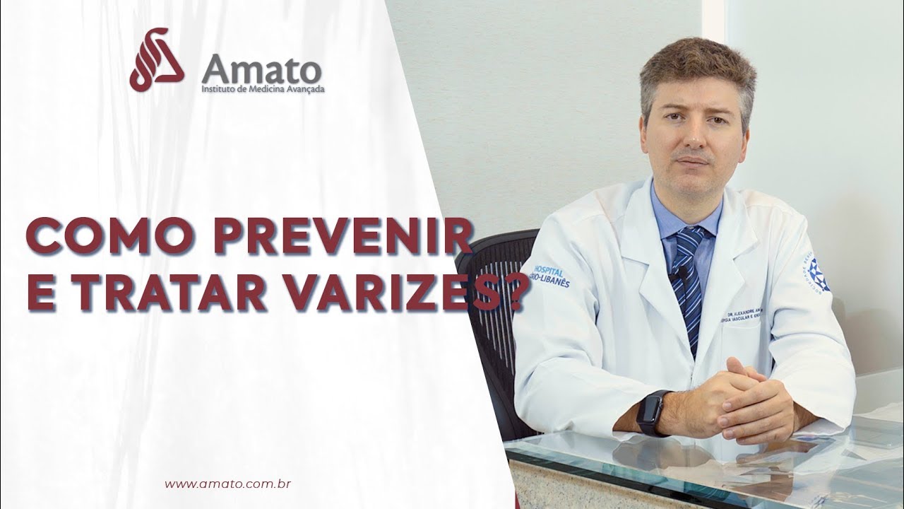 Como Prevenir e Tratar Varizes? D&aacute; para evitar?