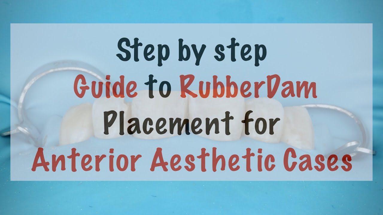 7 Simple steps to Master Rubber dam placement for Anterior Aesthetic cases