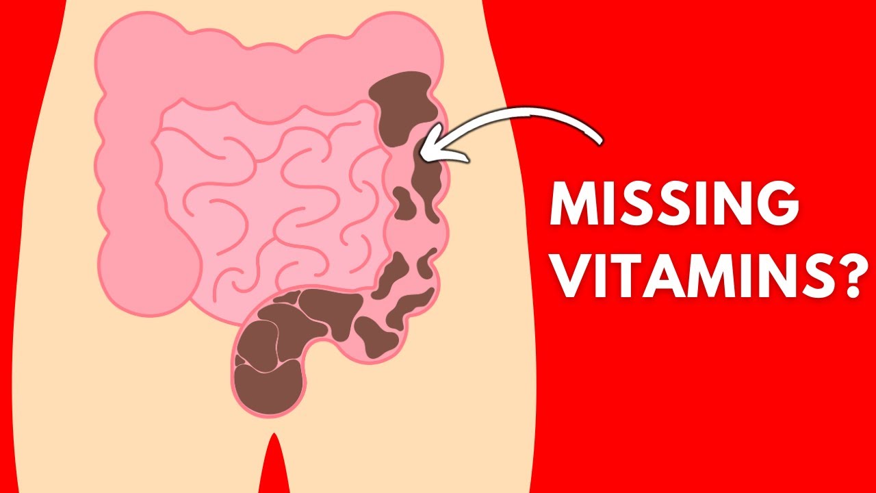 Fix constipation with 2 nutrients - it’s not what you think!