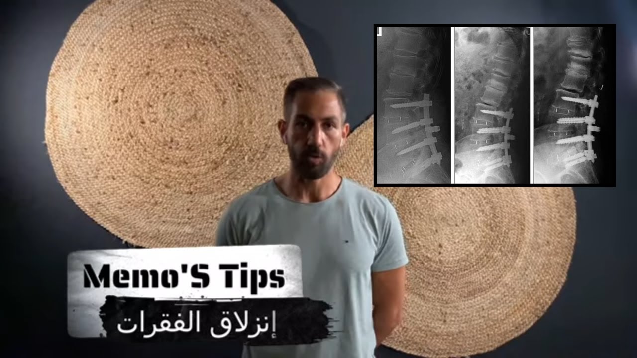 ٦٠ - إنزلاق الفقرات - سبب لمعظم الحالات وتمارين العلاج لتفادي  تثبيت الفقرات - المرحلة الأولى