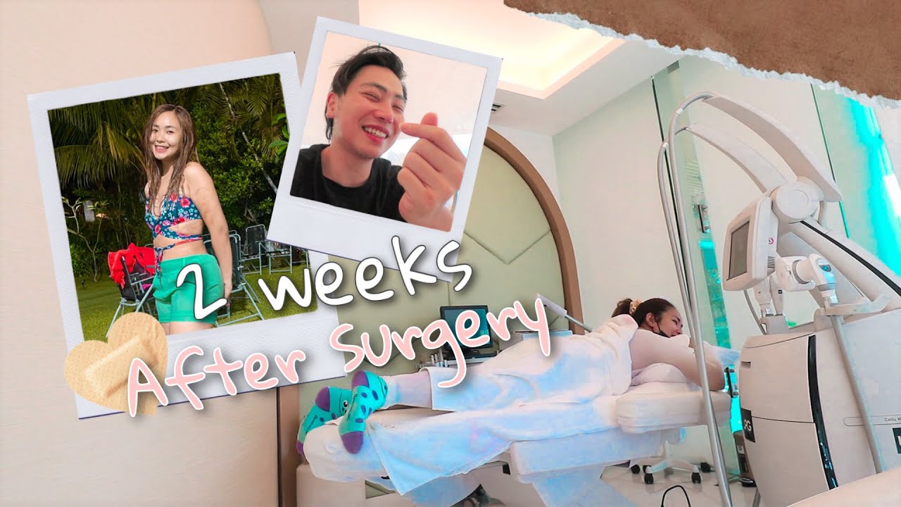 LIPO SURGERY UPDATE!