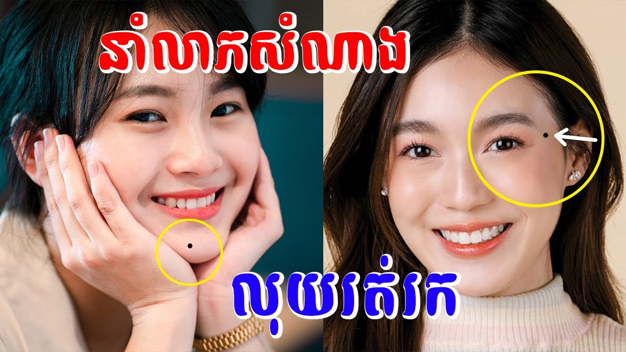 ប្រជ្រុយ ៣ កន្លែង បើអ្នកមានវាសំណាងខ្លាំងពេលចាស់ទៅ | lucky moles on body