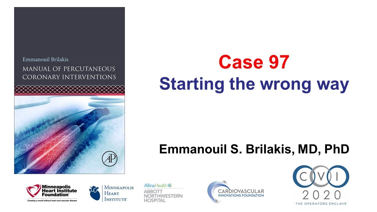 Case 97: PCI Manual - Starting the wrong way