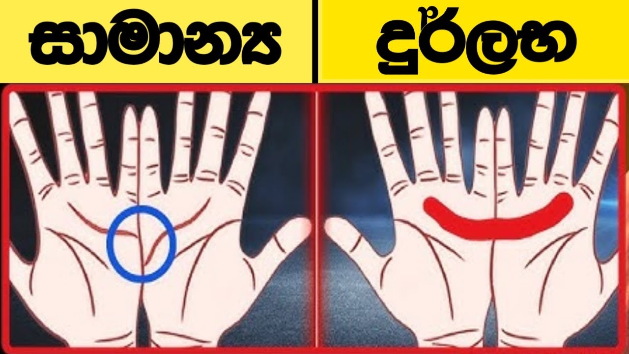 ඔයාගේ අතෙත් මේ දුර්ලභ සලකුන තියෙනවද? එහෙනම් මේ දේවල් 06 සිද්ධ වෙන එක වෙනවාමයී. ! පරිස්සම් වෙන්න