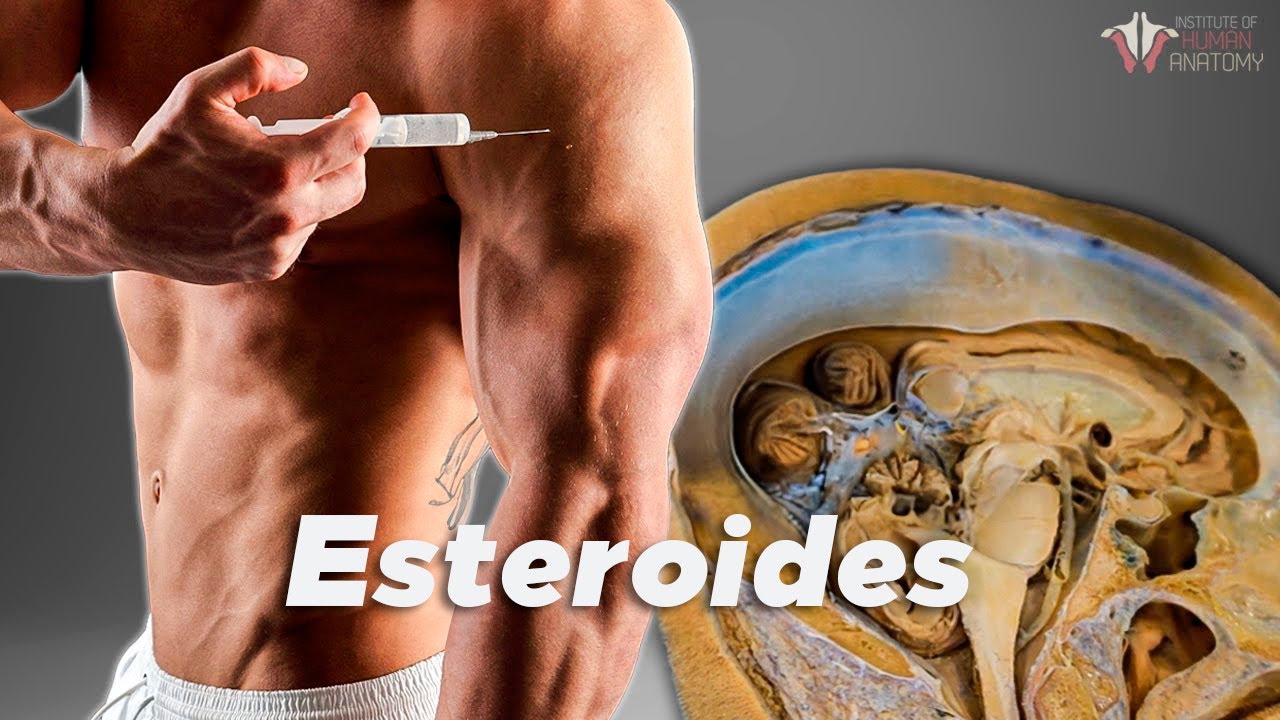 ¿Qué le hacen los esteroides a tu cuerpo?
