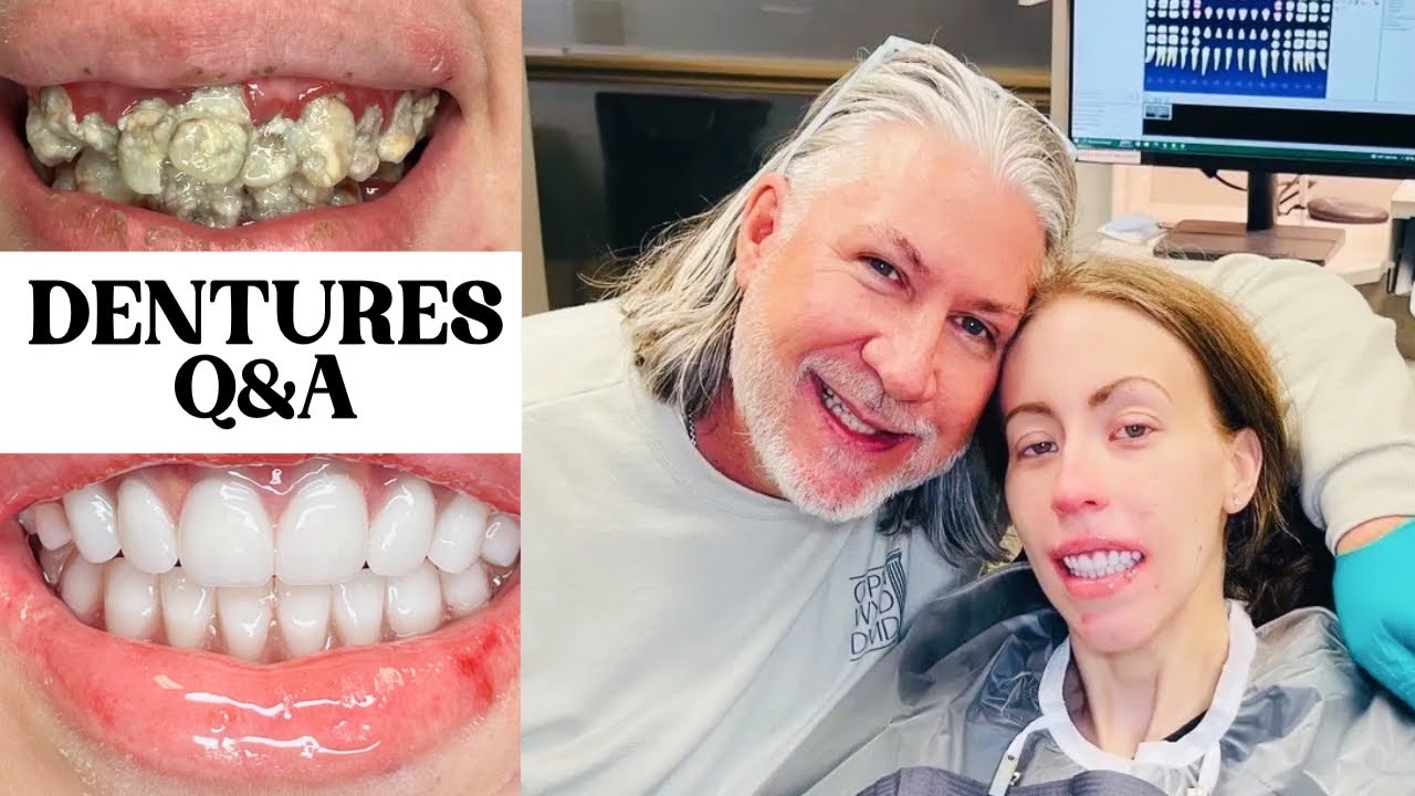 Q&A: DENTURES, SURGERY, PAIN & MORE