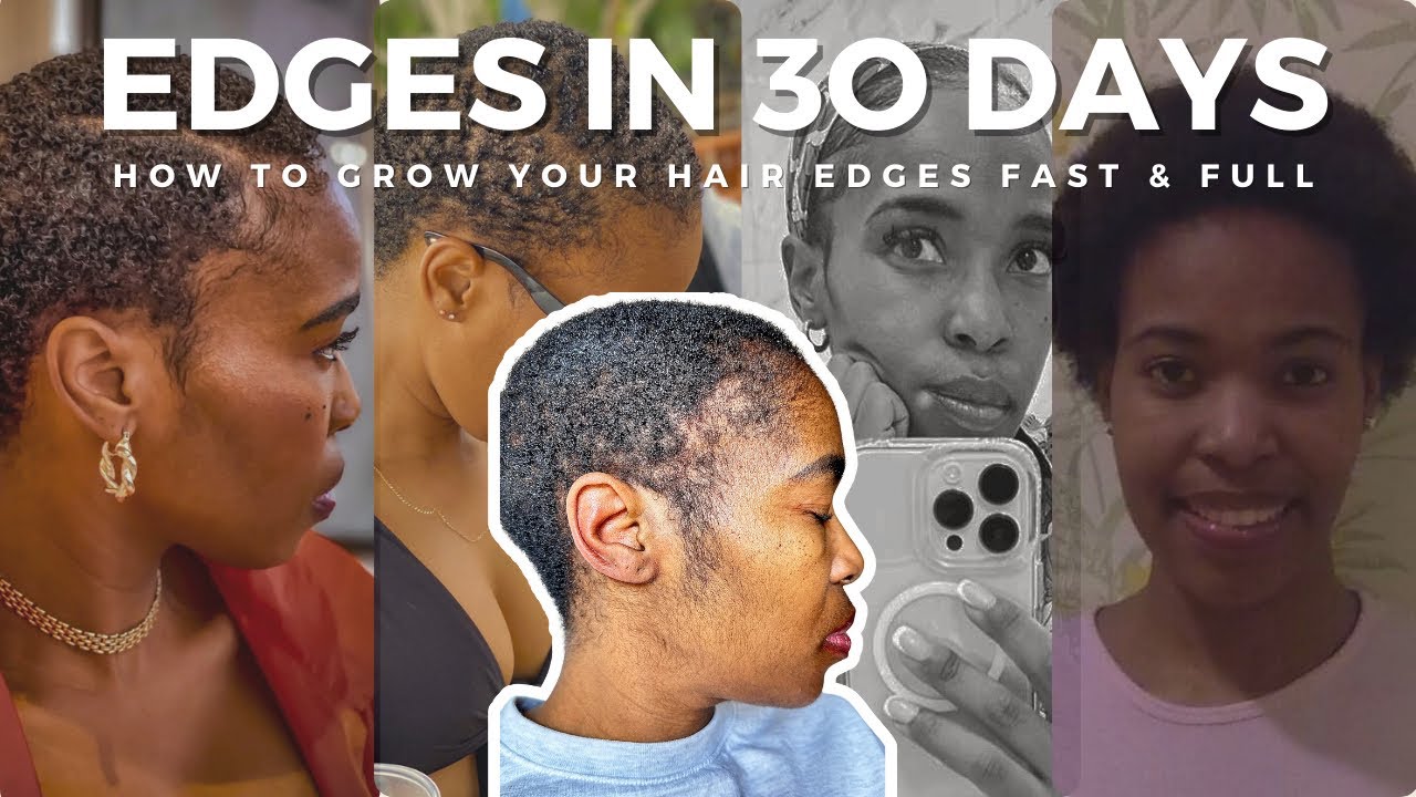 How Minoxidil grew my HAIR excessively