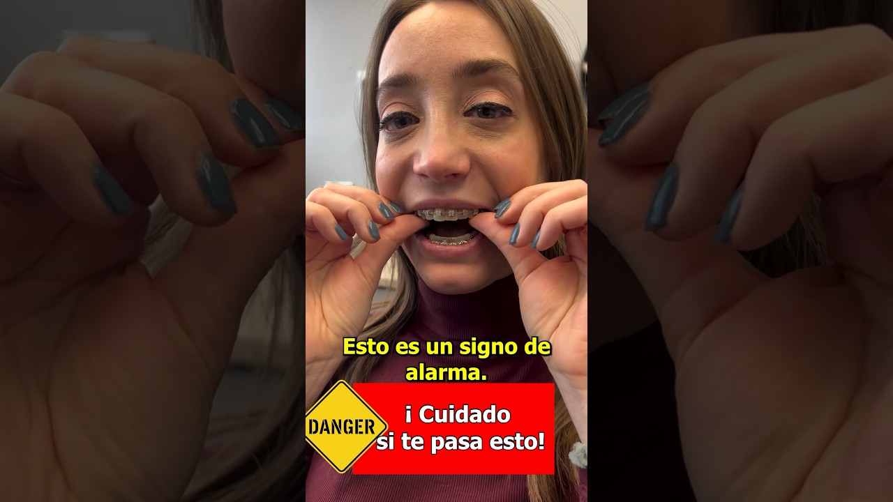 &iexcl;CUIDADO!Si se te mueven los dientes as&iacute; con los brackets