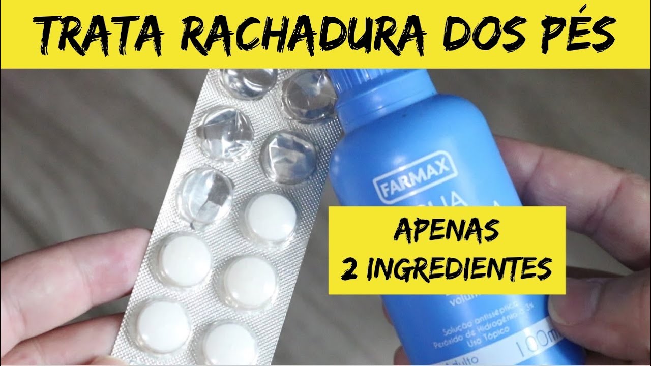 ACABA COM AS RACHADURAS DOS PÉS Somente 2 Ingredientes