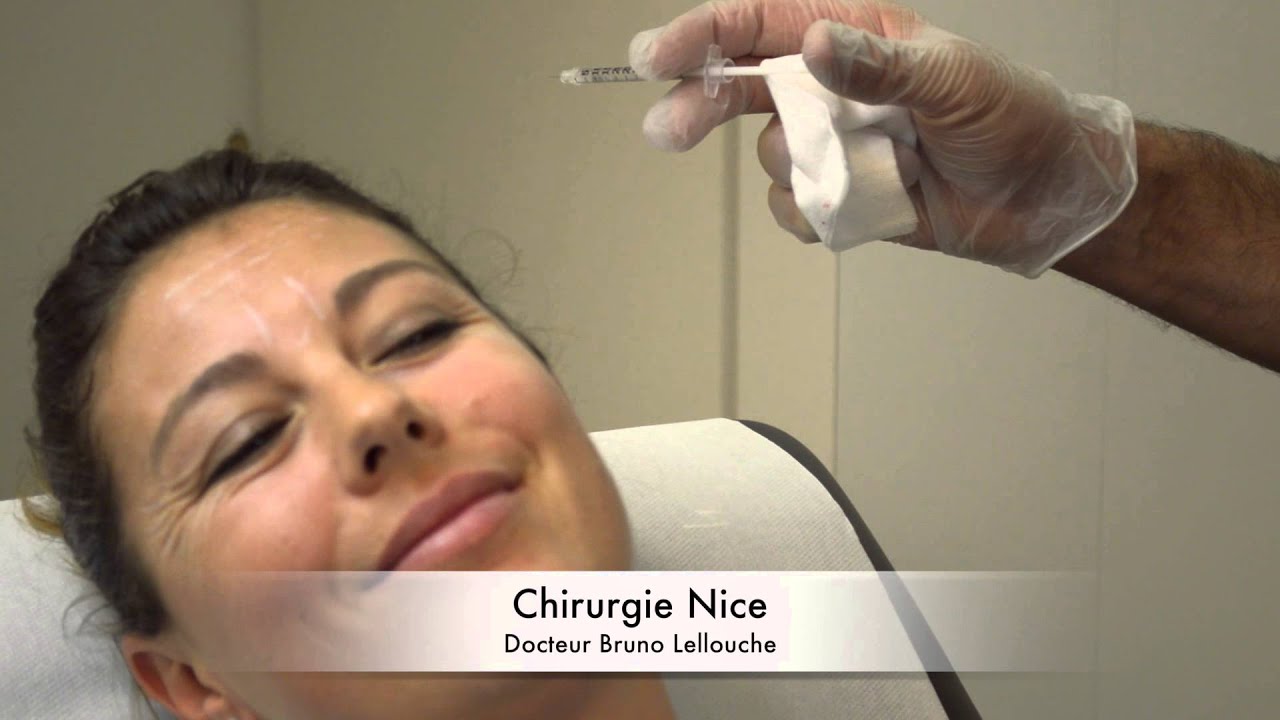 Injections de Botox dans les rides du front
