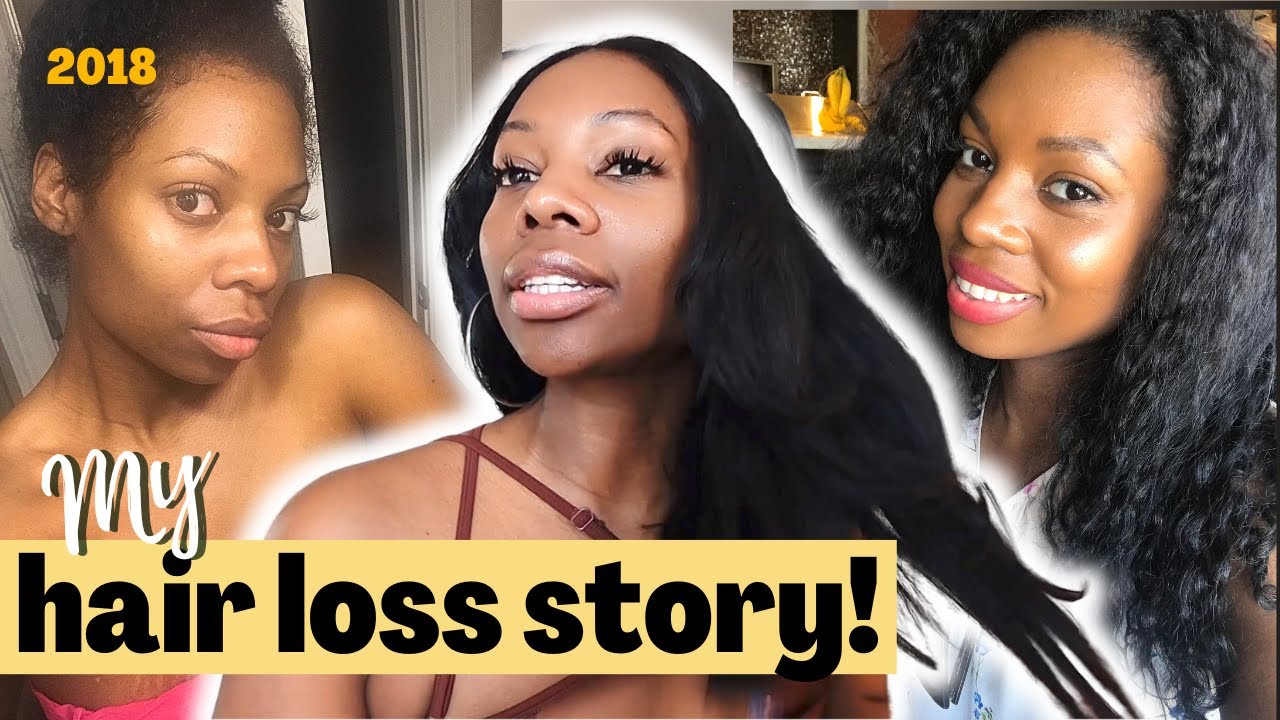 HOW I GREW MY HAIR BACK! My Hair Loss Story!