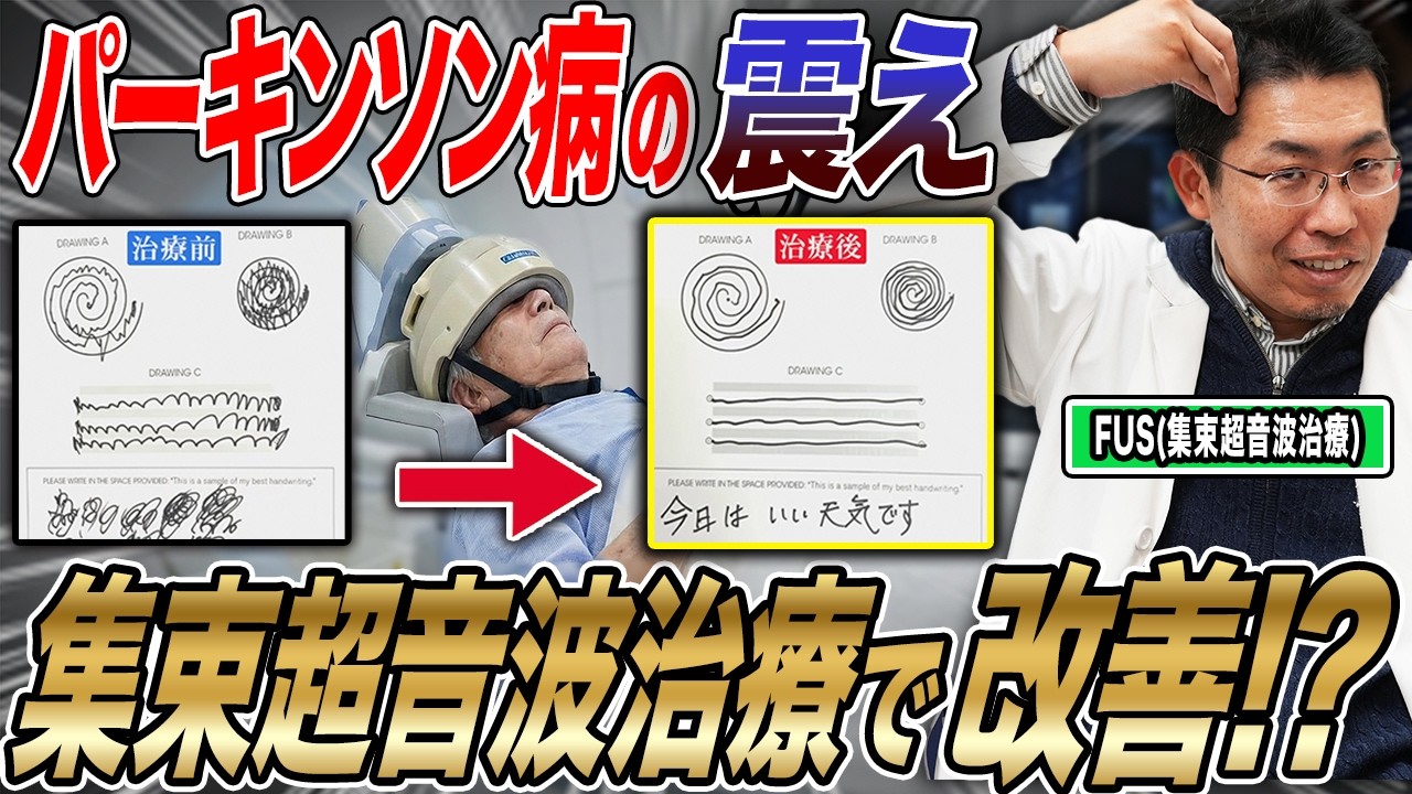 【パーキンソン病】症状が和らぐ患者も…手足の震えにメスを使わない『集束超音波治療』とは！？