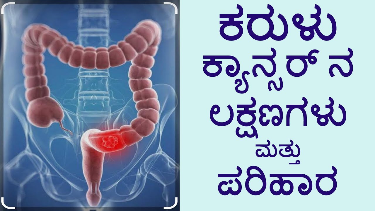 ಕರುಳು ಕ್ಯಾನ್ಸರ್ ನ ಲಕ್ಷಣಗಳು ಮತ್ತು ಪರಿಹಾರ || Symptoms and Remedies of Colon Cancer